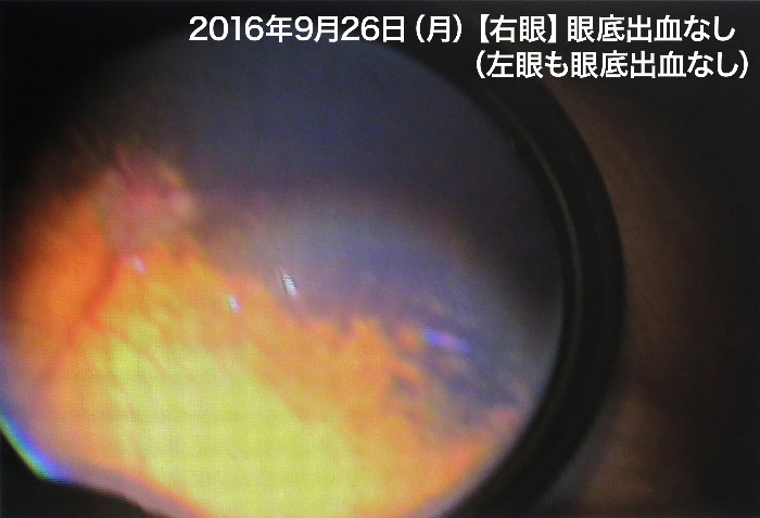 ファイル 5921-3.jpg