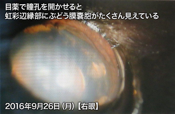 ファイル 5921-5.jpg