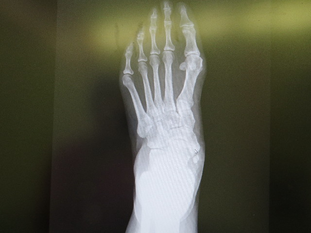 ファイル 7165-3.jpg