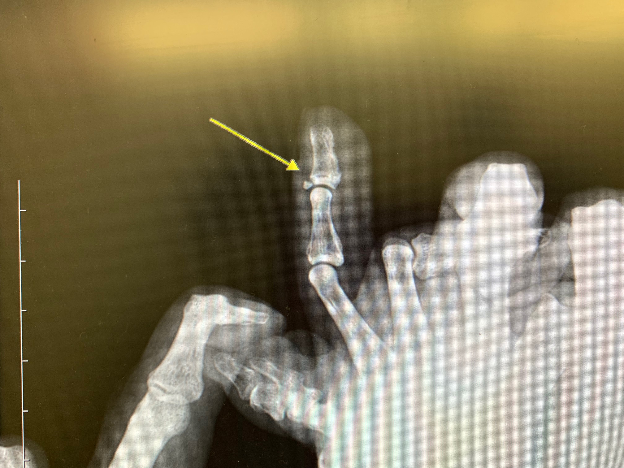 ファイル 8393-3.jpg