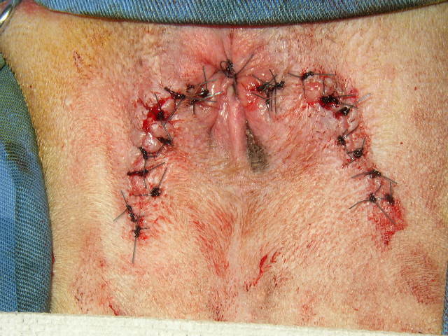 ファイル 873-3.jpg